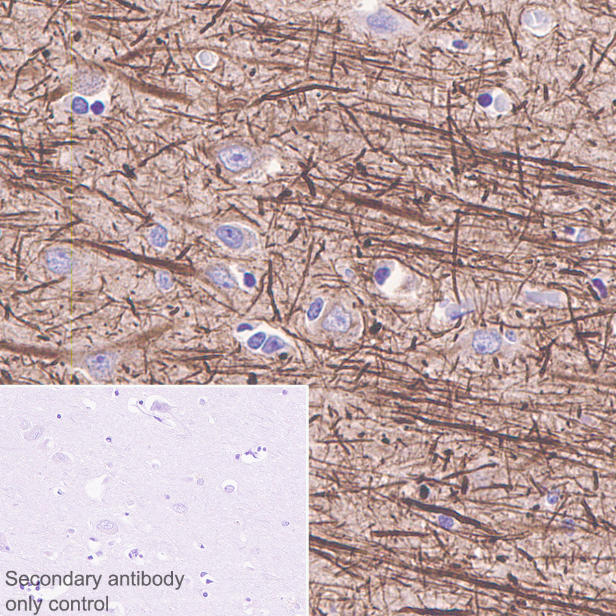 Immunohistochemistry (Formalin/PFA-fixed paraffin-embedded sections) - Anti-68kDa Neurofilament/NF-L antibody [Nfl21] (AB273441), expandable thumbnail