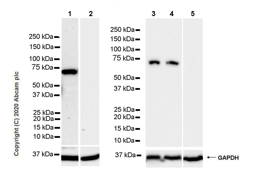 Western blot - Anti-68kDa Neurofilament/NF-L antibody [Nfl21] (AB273441), expandable thumbnail