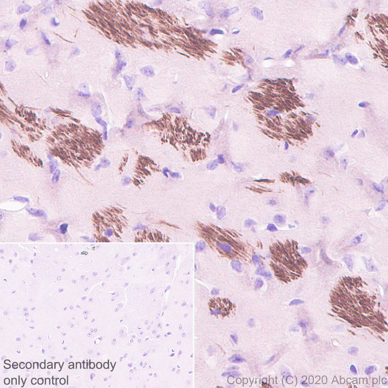 Immunohistochemistry (Formalin/PFA-fixed paraffin-embedded sections) - Anti-68kDa Neurofilament/NF-L antibody [Nfl21] - BSA and Azide free (AB273479)