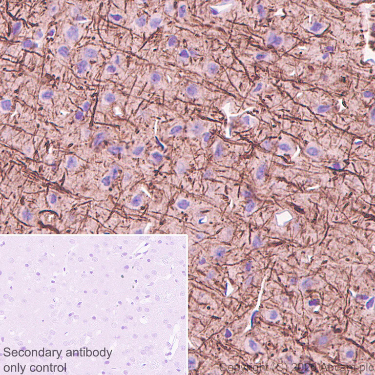 Immunohistochemistry (Formalin/PFA-fixed paraffin-embedded sections) - Anti-68kDa Neurofilament/NF-L antibody [Nfl21] - BSA and Azide free (AB273479)