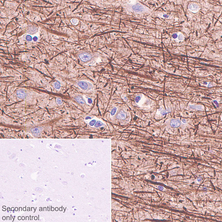 Immunohistochemistry (Formalin/PFA-fixed paraffin-embedded sections) - Anti-68kDa Neurofilament/NF-L antibody [Nfl21] - BSA and Azide free (AB273479)