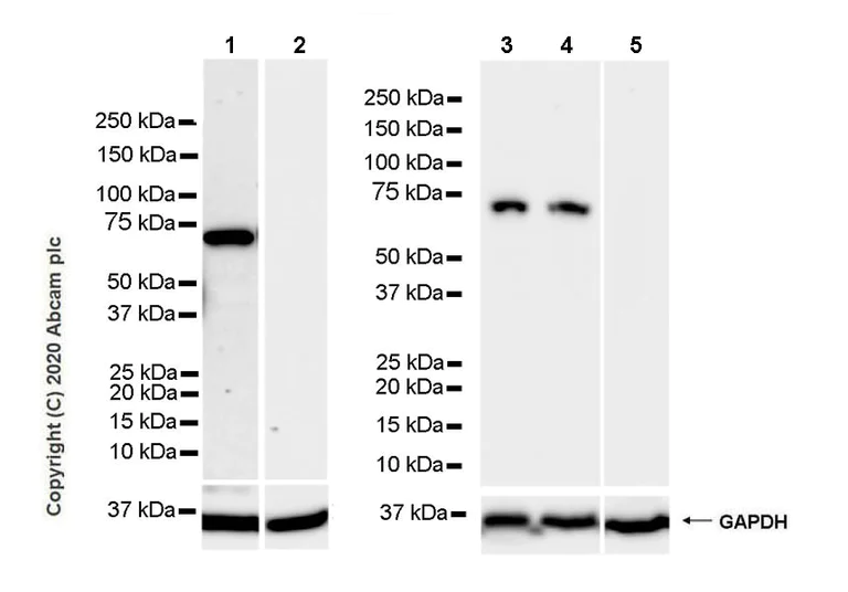 Western blot - Anti-68kDa Neurofilament/NF-L antibody [Nfl21] - BSA and Azide free (AB273479)