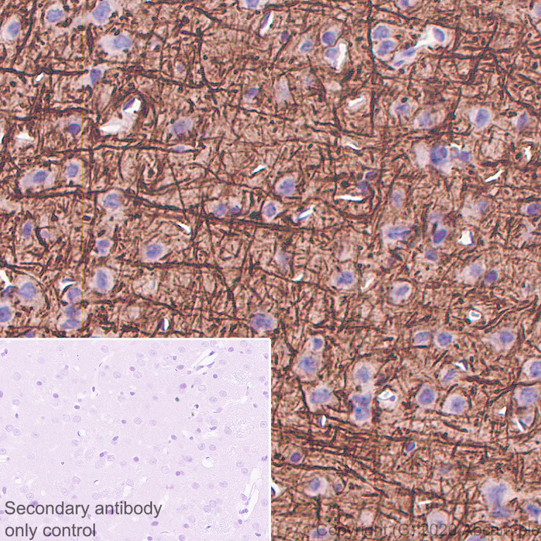 Immunohistochemistry (Formalin/PFA-fixed paraffin-embedded sections) - Anti-68kDa Neurofilament/NF-L antibody [NfL23] - BSA and Azide free (AB273480)