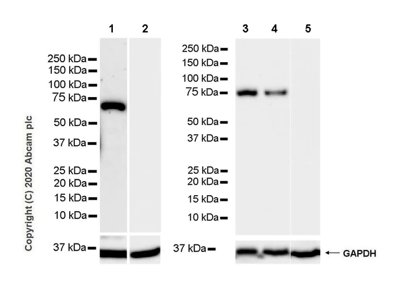Western blot - Anti-68kDa Neurofilament/NF-L antibody [NfL23] - BSA and Azide free (AB273480)