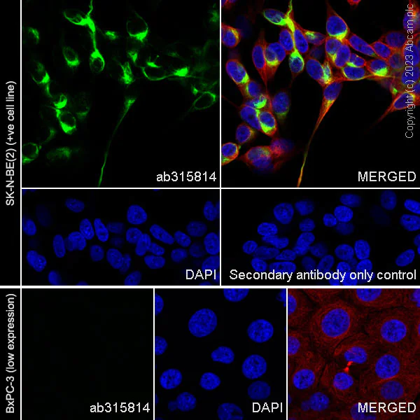 Immunocytochemistry/ Immunofluorescence - Anti-68kDa Neurofilament/NF-L (C-term) antibody [EPR28784-63] (AB315814)