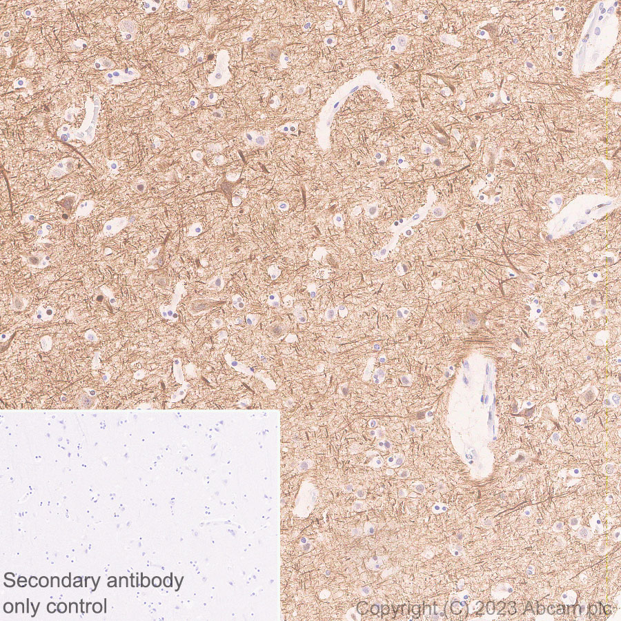 Immunohistochemistry (Formalin/PFA-fixed paraffin-embedded sections) - Anti-68kDa Neurofilament/NF-L (C-term) antibody [EPR28784-63] (AB315814), expandable thumbnail