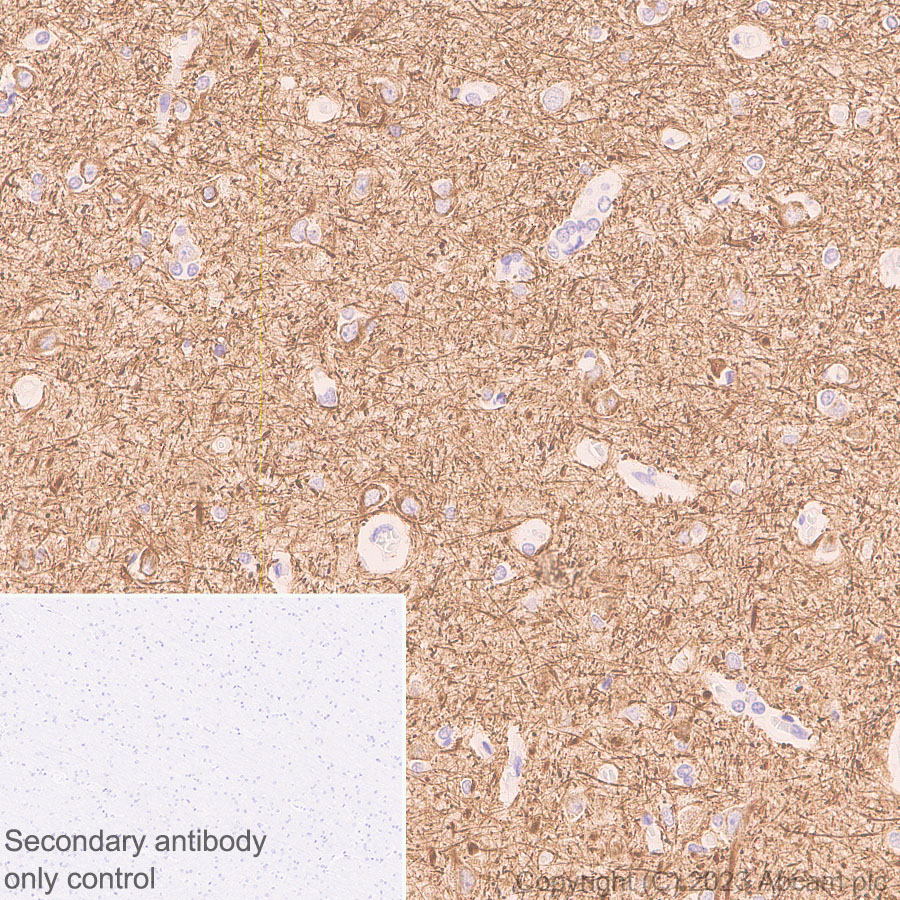 Immunohistochemistry (Formalin/PFA-fixed paraffin-embedded sections) - Anti-68kDa Neurofilament/NF-L (C-term) antibody [EPR28784-63] (AB315814), expandable thumbnail