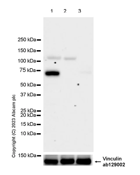 Western blot - Anti-68kDa Neurofilament/NF-L (C-term) antibody [EPR28784-63] (AB315814)