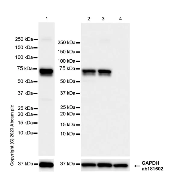 Western blot - Anti-68kDa Neurofilament/NF-L (C-term) antibody [EPR28784-63] (AB315814)