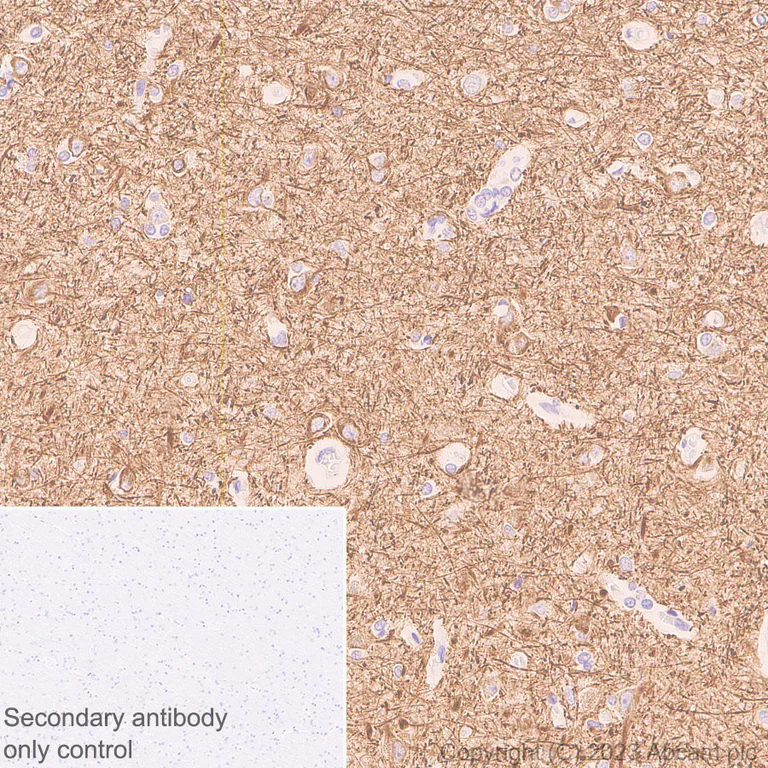 Immunohistochemistry (Formalin/PFA-fixed paraffin-embedded sections) - Anti-68kDa Neurofilament/NF-L (C-term) antibody [EPR28784-63] - BSA and Azide free (AB315815)
