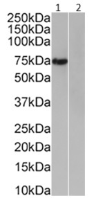 Western blot - Anti-6X His tag® antibody [3D5] - C-terminal (AB206504)