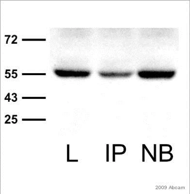 Immunoprecipitation - Anti-6X His tag® antibody [4D11] (AB5000)