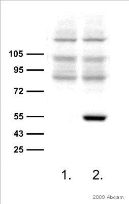 Western blot - Anti-6X His tag® antibody [4D11] (AB5000)