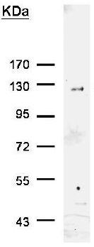 Immunoprecipitation - Anti-6X His tag® antibody (AB137839)