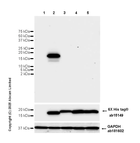Western blot - Anti-6X His tag® antibody [AD1.1.10] (AB15149)