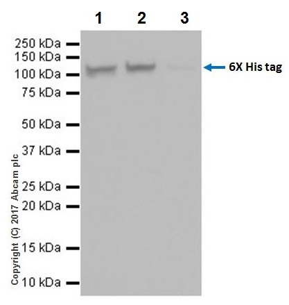 Immunoprecipitation - Anti-6X His tag® antibody [EPR20547] - ChIP Grade (AB213204), expandable thumbnail