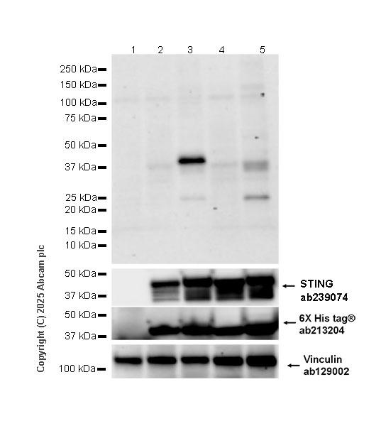 Western blot - Anti-6X His tag® antibody [EPR20547] - ChIP Grade (ab213204), expandable thumbnail