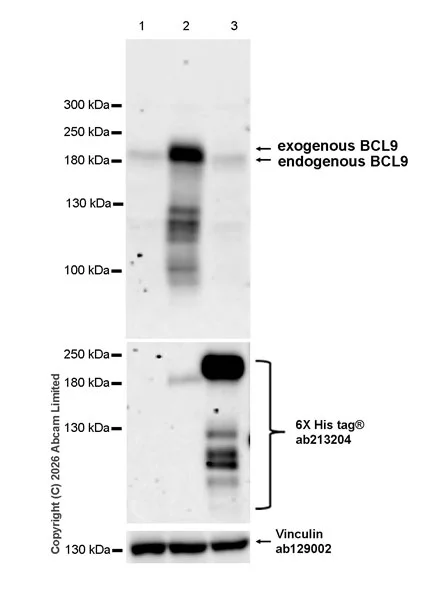 Western blot - Anti-6X His tag® antibody [EPR20547] - ChIP Grade (AB213204)
