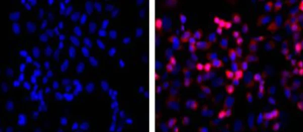 Immunocytochemistry/ Immunofluorescence - Anti-6X His tag® antibody [HIS.H8] (AB18184)