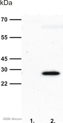 Western blot - Anti-6X His tag® antibody [HIS.H8] (AB18184)