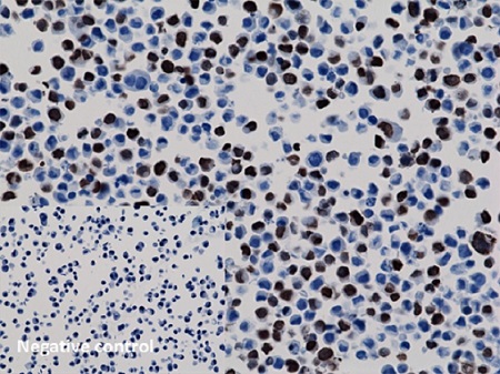 Immunocytochemistry - Anti-6X His tag® antibody [RM146] (AB200537)