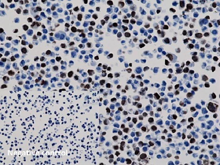 Immunocytochemistry - Anti-6X His tag® antibody [RM146] (AB200537)