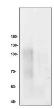 Western blot - Anti-7-Methylguanosine antibody (AB286165)