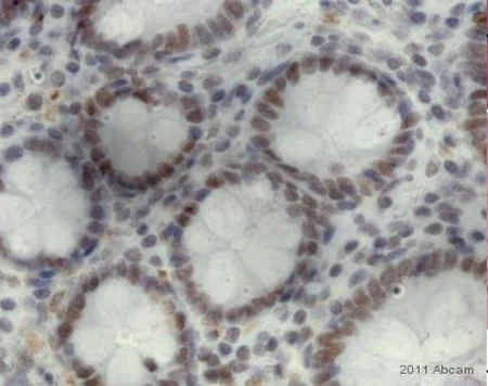 Immunohistochemistry (Formalin/PFA-fixed paraffin-embedded sections) - Anti-8-Hydroxy-2'-deoxyguanosine antibody [N45.1] (AB48508)