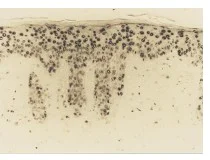 Immunohistochemistry (Formalin/PFA-fixed paraffin-embedded sections) - Anti-8-Hydroxy-2'-deoxyguanosine antibody [N45.1] (AB48508)