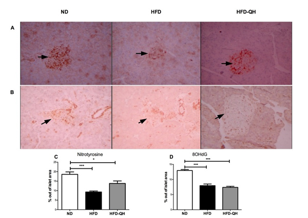 Immunohistochemistry (Formalin/PFA-fixed paraffin-embedded sections) - Anti-8-Hydroxy-2'-deoxyguanosine antibody [N45.1] (AB48508)