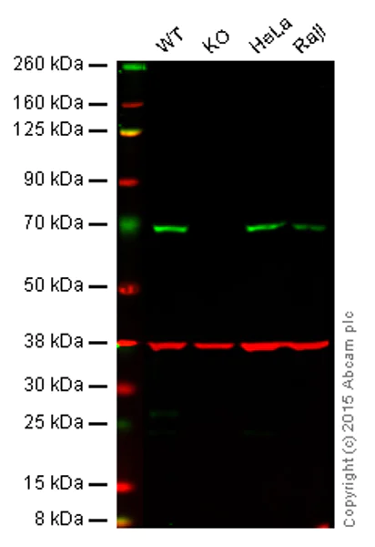 Western blot - Anti-A-Raf antibody [EPR16208] (AB200653)