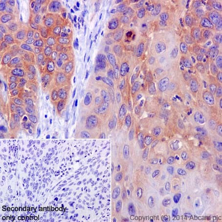 Immunohistochemistry (Formalin/PFA-fixed paraffin-embedded sections) - Anti-A-Raf antibody [EPR16208] - BSA and Azide free (AB240354), expandable thumbnail