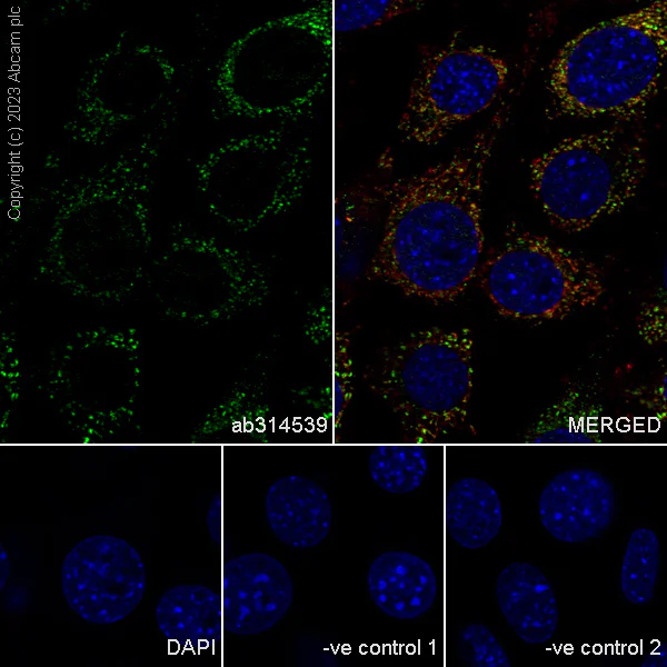 Immunocytochemistry/ Immunofluorescence - Anti-A-Raf antibody [EPR25405-17] (AB314539)