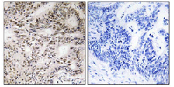 Immunohistochemistry (Formalin/PFA-fixed paraffin-embedded sections) - Anti-A-Raf (phospho S299) antibody (AB112053), expandable thumbnail