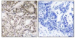 Immunohistochemistry (Formalin/PFA-fixed paraffin-embedded sections) - Anti-A-Raf (phospho S299) antibody (AB112053)