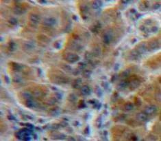Immunohistochemistry (Formalin/PFA-fixed paraffin-embedded sections) - Anti-A1BG antibody (AB231784)