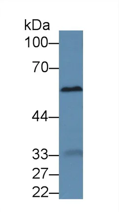 Western blot - Anti-A1BG antibody (AB231784)