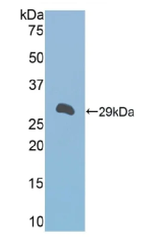 Western blot - Anti-A1BG antibody (AB231784)