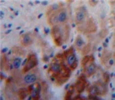 Immunohistochemistry (Formalin/PFA-fixed paraffin-embedded sections) - Anti-A1BG antibody (AB231805)