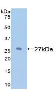 Western blot - Anti-A1BG antibody (AB231805)