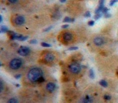 Immunohistochemistry (Formalin/PFA-fixed paraffin-embedded sections) - Anti-A1BG antibody (AB231809)