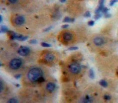 Immunohistochemistry (Formalin/PFA-fixed paraffin-embedded sections) - Anti-A1BG antibody (AB231809)