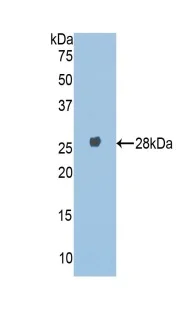 Western blot - Anti-A1BG antibody (AB231809)