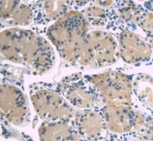 Immunohistochemistry (Formalin/PFA-fixed paraffin-embedded sections) - Anti-A1BG antibody [D6] (AB239588)