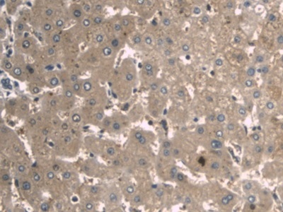 Immunohistochemistry (Formalin/PFA-fixed paraffin-embedded sections) - Anti-A1BG antibody [D6] (AB239588)