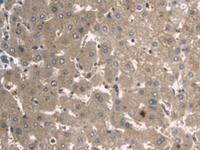 Immunohistochemistry (Formalin/PFA-fixed paraffin-embedded sections) - Anti-A1BG antibody [D6] (AB239588)