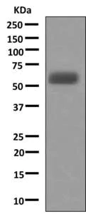 Western blot - Anti-A1BG antibody [EPR9830(B)] (AB156009)