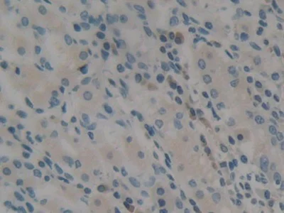 Immunohistochemistry (Formalin/PFA-fixed paraffin-embedded sections) - Anti-A1CF/ACF antibody (AB231614)
