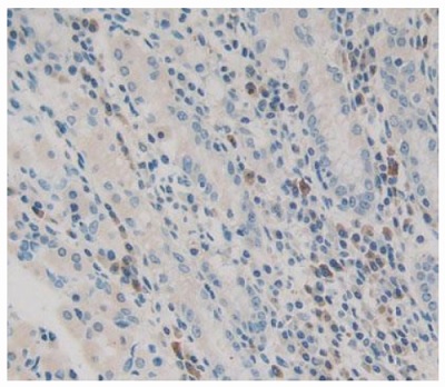 Immunohistochemistry (Formalin/PFA-fixed paraffin-embedded sections) - Anti-A1CF/ACF antibody (AB231614)