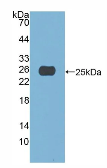 Western blot - Anti-A1CF/ACF antibody (AB231614)